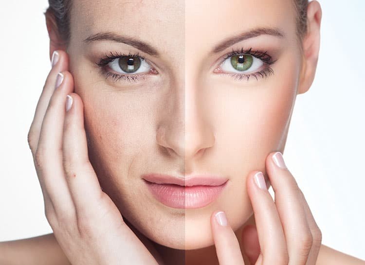 عمليات-تجميل-بدون-جراحة-بدون-الم