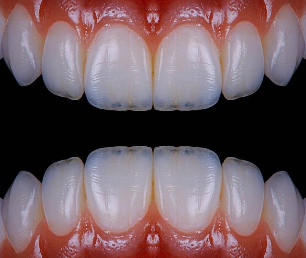 عيادة-تجميل-اسنان-جدة