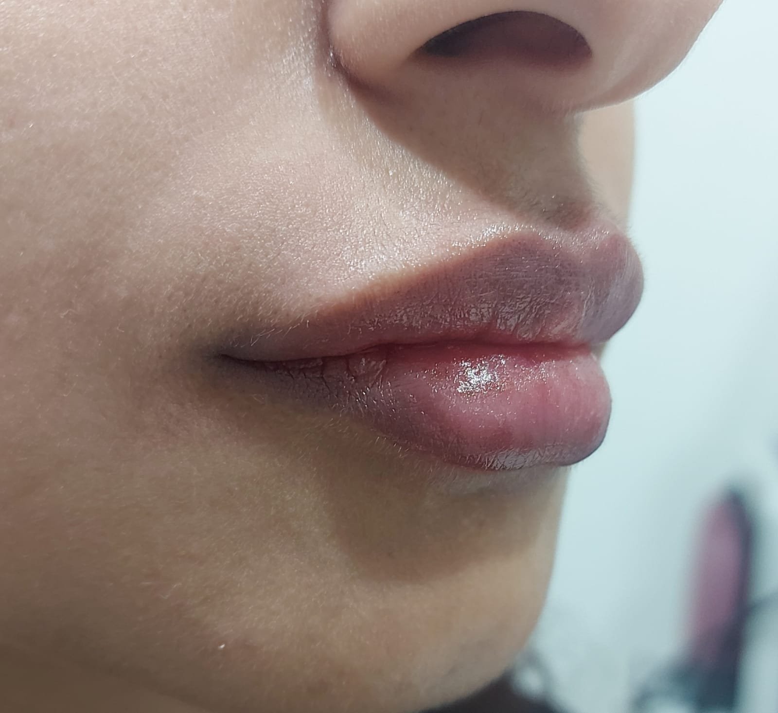 after